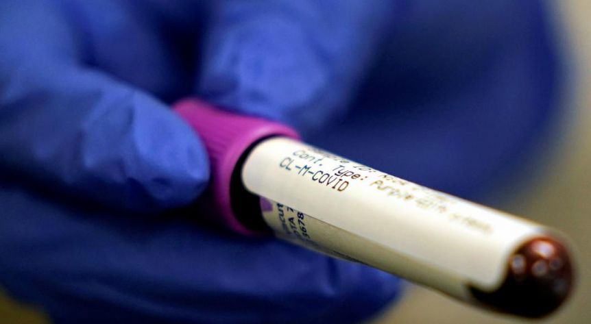 Coronavirus en alza: fueron confirmados 1.374 nuevos casos y 24 fallecidos