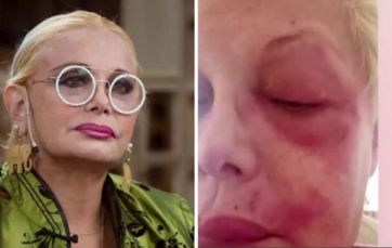 Carmen Barbieri está complicada de salud y confesó que podría perder un ojo