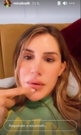 Mica Tinelli le respondió a una seguidora que la criticó por retocarse los labios