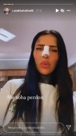 Candelaria Tinelli se operó y contó los detalles en sus redes