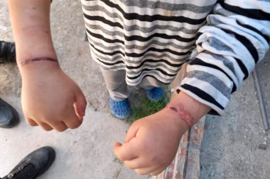 Rescataron a un nene de seis años que permanecía atado en su casa