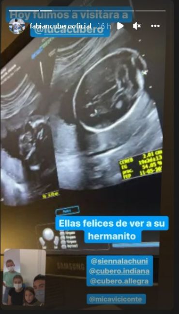 Mica Viciconte compartió la última ecografía de su embarazo y mostró la carita de Luca