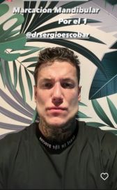 El drástico cambio de Alex Caniggia tras un retoque facial