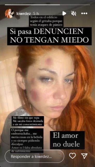Lourdes de Bandana denunció a su ex novio por violencia de género