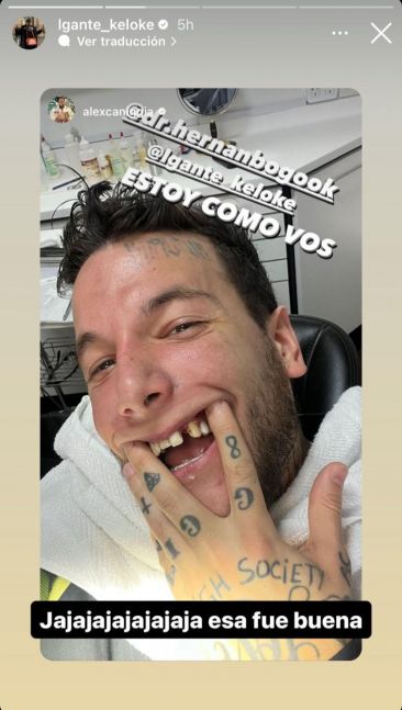 Alex Caniggia fue al odontólogo y se burló de Lgante al mostrar su dentadura
