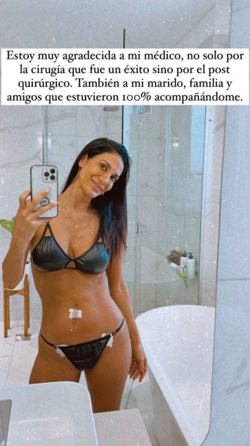 Silvina Escudero posó en ropa interior para mostrar cómo quedó su cuerpo tras una operación