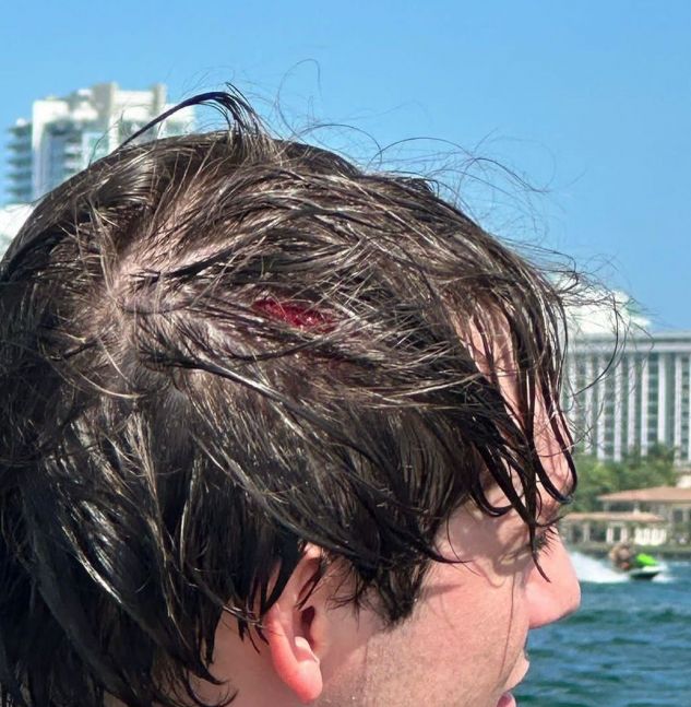 Paulo Londra sufrió un tremendo accidente con su moto de agua en Miami: cómo está de salud