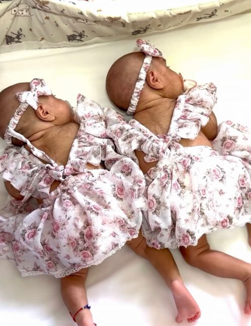Las gemelas Medina-Celis cumplieron un mes y sus papás decidieron mostrarlas