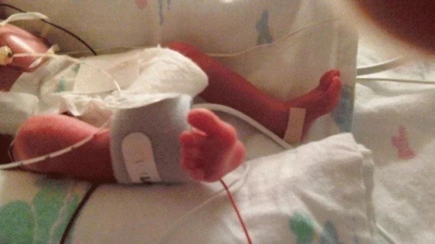 Una beba prematura casi fue enterrada viva y sus familiares quedaron impactados